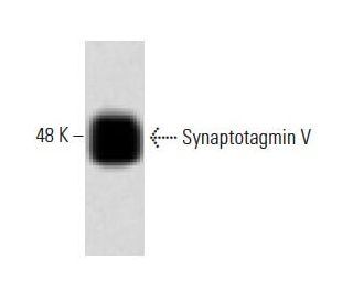 Synaptotagmin V Antibody (46) - Western Blotting - Image 60462