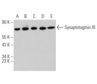Synaptotagmin XI Antibody (H-7) - Western Blotting - Image 370038