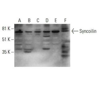 Syncoilin Antibody (C-3) - Western Blotting - Image 348617