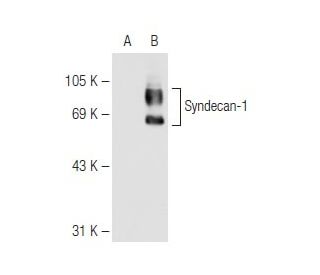 CD138/SDC1/Syndecan-1 Antibody (2Q1484) - Western Blotting - Image 82559