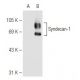 CD138/SDC1/Syndecan-1 Antibody (2Q1484) - Western Blotting - Image 82559