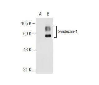 CD138/SDC1/Syndecan-1 Antibody (5G72) - Western Blotting - Image 82557