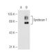 CD138/SDC1/Syndecan-1 Antibody (5G72) - Western Blotting - Image 82557