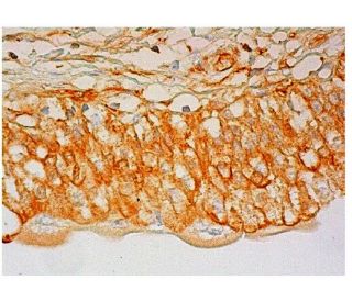 CD138/SDC1/Syndecan-1 Antibody (A-6) | SCBT - Santa Cruz Biotechnology
