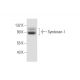 western blotting image from recommended CD138/SDC1/Syndecan-1 (A-6) monoclonal antibody replacement. Image 295808