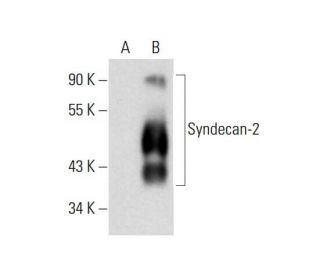 western blotting image from recommended CD362/SDC2/Syndecan-2 (H-7) monoclonal antibody replacement. Image 143397
