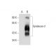 western blotting image from recommended CD362/SDC2/Syndecan-2 (H-7) monoclonal antibody replacement. Image 143397