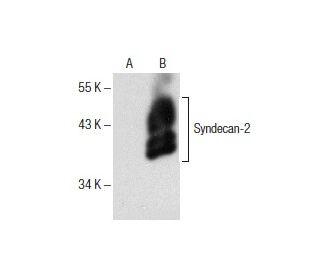 western blotting image from recommended CD362/SDC2/Syndecan-2 (F-5) monoclonal antibody replacement. Image 154113