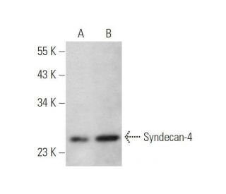 western blotting image from recommended SYND4/SDC4/Syndecan-4 (5G9) monoclonal antibody replacement. Image 352774