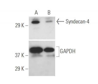 Syndecan-4 siRNA (h): sc-36588. Western blot analysis of Syndecan-4 expression in non-transfected control (A) and Syndecan 