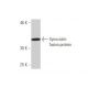 Synoviolin Antibody (4H4) - Western Blotting - Image 350287
