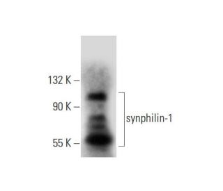 synphilin-1 Antibody (F-9) - Western Blotting - Image 144654 