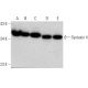 Este anticorpo policlonal foi descontinuado. Consulta o nosso anticorpo monoclonal <a href="syntaxin-4-antibody-qq-17">Syntaxin 4 (QQ-17)</a> recomendado (dados de amostra apresentados). western blotting image from recommended Syntaxin 4 (QQ-17) monoclonal antibody replacement. Image 368199