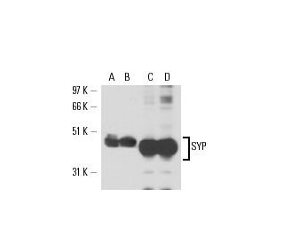 SYP/Synaptophysin Antibody (4H255) - Western Blotting - Image 17353 