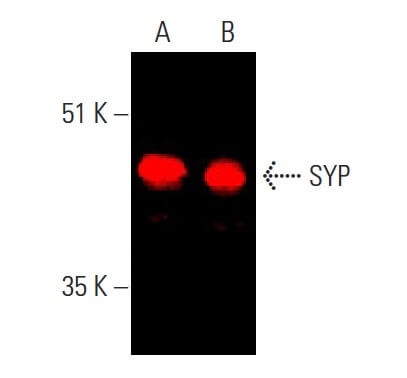 SYP/Synaptophysin Antibody (D-4) | SCBT - Santa Cruz