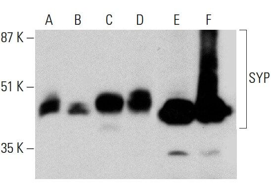 SYP/Synaptophysin Antibody (D-4) | SCBT - Santa Cruz