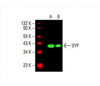 SYP/Synaptophysin Antibody (D-4) | SCBT - Santa Cruz