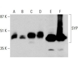 western blotting image from recommended SYP/Synaptophysin (D-4) monoclonal antibody replacement. Image 385688