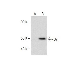 SYT Antibody (E-5) - Western Blotting - Image 149675