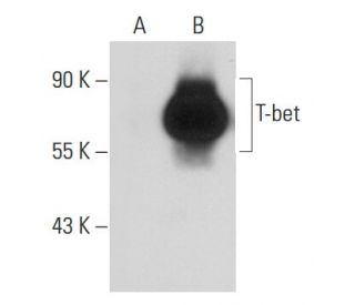 T-bet/TBX21 Antibody (39D) - Western Blotting - Image 33412 