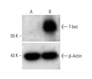 T-bet CRISPR Activation Plasmid (h): sc-400480-ACT. Western blot analysis of T-bet expression in non-transfected control (Each CRISPR/Cas9 Knockout (KO) Plasmid product consists of a pool of 3 plasmids designed to ensure identification and cleavage of a specific gene for maximum knockout efficiency. Each plasmid encodes a unique 20 nt sequence derived from the GeCKO (v2) library.