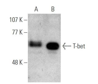 T-bet/TBX21 Antibody (4B10) - Western Blotting - Image 372277