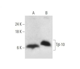 Tβ-10 Antibody (D-6) - Western Blotting - Image 319567Each CRISPR/Cas9 Knockout (KO) Plasmid product consists of a pool of 3 plasmids designed to ensure identification and cleavage of a specific gene for maximum knockout efficiency. Each plasmid encodes a unique 20 nt sequence derived from the GeCKO (v2) library.