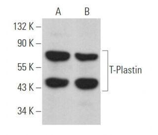 T-Plastin Antibody (A-3) - Western Blotting - Image 364184 