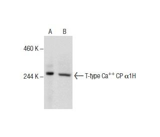 western blotting image from recommended T-type Ca++ CP α1H (G-10) monoclonal antibody replacement. Image 157480