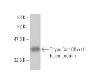 T-type Ca<sup>++</sup> CP &alpha;1I Antibody (3H5) - Western Blotting - Image 348981