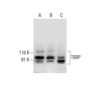 T6BP Antibody (H-6) - Western Blotting - Image 294101Each CRISPR/Cas9 Knockout (KO) Plasmid product consists of a pool of 3 plasmids designed to ensure identification and cleavage of a specific gene for maximum knockout efficiency. Each plasmid encodes a unique 20 nt sequence derived from the GeCKO (v2) library.