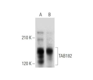 TAB182 Antibody (D-5) - Western Blotting - Image 320932 