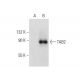 TAB2 Antibody (E-5) - Western Blotting - Image 301455