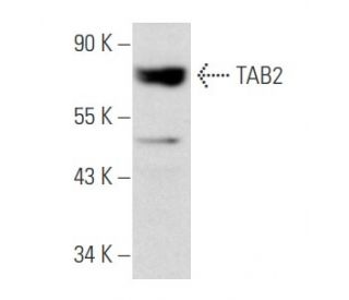 western blotting image from recommended TAB2 (E-5) monoclonal antibody replacement. Image 355793