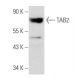 western blotting image from recommended TAB2 (E-5) monoclonal antibody replacement. Image 355793