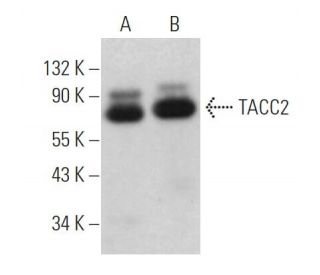 TACC2 Antibody (H-8) - Western Blotting - Image 371093 