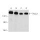 western blotting image from recommended TACC3 (C-2) monoclonal antibody replacement. Image 357960