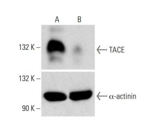 TACE CRISPR/Cas9 KO Plasmid (h): sc-400827. Western blot analysis of... 