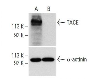 TACE siRNA (h): sc-36604. Western blot analysis of TACE expression in non-transfected control (A) and TACE siRNA transfect 