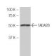 TADA2B Antibody (MB-56) - Western Blotting - Image 53979