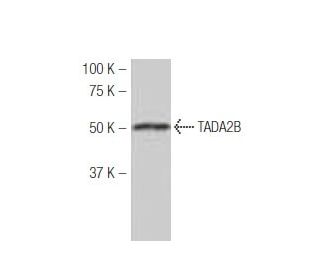 TADA2B Antibody (MB-56) - Western Blotting - Image 53979The Double Nickase Plasmid features a U6 promoter for sgRNA expression, a 20 nt targeting sequence, and a gRNA scaffold to guide Cas9n. It includes a CBh promoter for Cas9n (D10A) and puromycin resistance, GFP for transfection verification, and nuclear localization signals (NLS). The 2A peptide allows co-expression of Cas9n and Puro from a single promoter, enabling precise genome editing with reduced off-target effects.