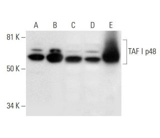 western blotting image from recommended TAF I p48 (A-10) monoclonal antibody replacement. Image 296969