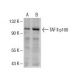 TAF II p100 Antibody (H-3) - Western Blotting - Image 154909 