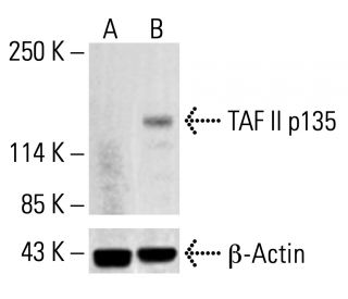 TAF II p135 Antibody (22) - Western Blotting - Image 412854