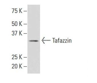 Tafazzin Antibody (JK-2) - Western Blotting - Image 34244 