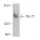 TAG-72 Antibody (6A191) - Western Blotting - Image 363189