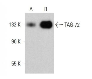 TAG-72 Antibody (6A191) - Western Blotting - Image 382635 
