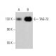 TAG-72 Antibody (6A191) - Western Blotting - Image 382635 
