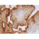 TAG-72 Antibody (B72.3) - Immunohistochemistry - Image 388734 