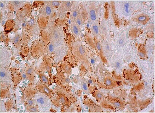tak1-antibody-h-5-